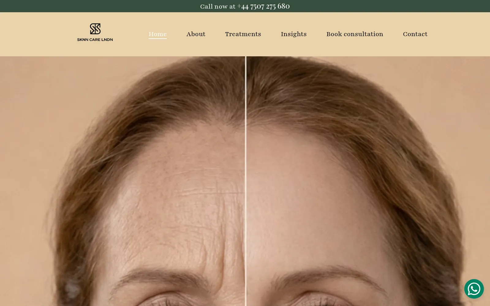 SKNN CARE LNDN website hero showing a before and after skin treatment comparison